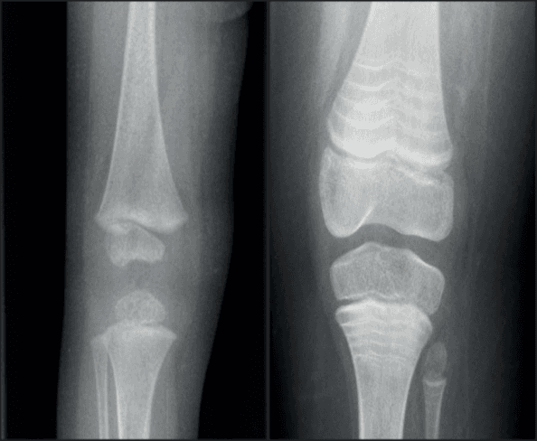 Possibility of hearing the voice of Prophet Muhammad through technology – A clue from the Quran