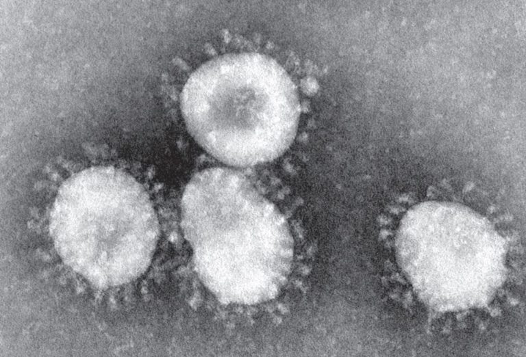 Opinion: I caught Covid-19, and here’s my experience 